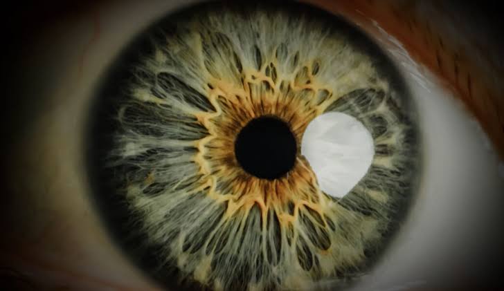 Silver and gold iris